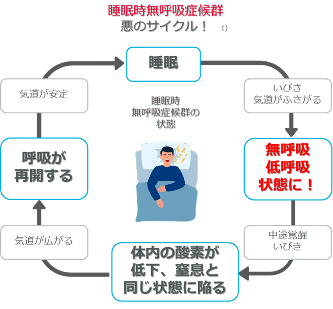 睡眠時無呼吸症候群とは？